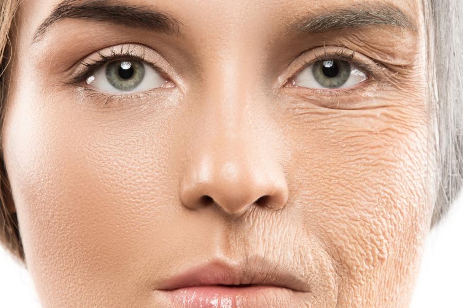 Anti Ageing Treatments