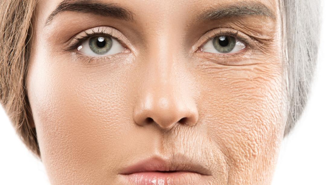 Anti Ageing Treatments