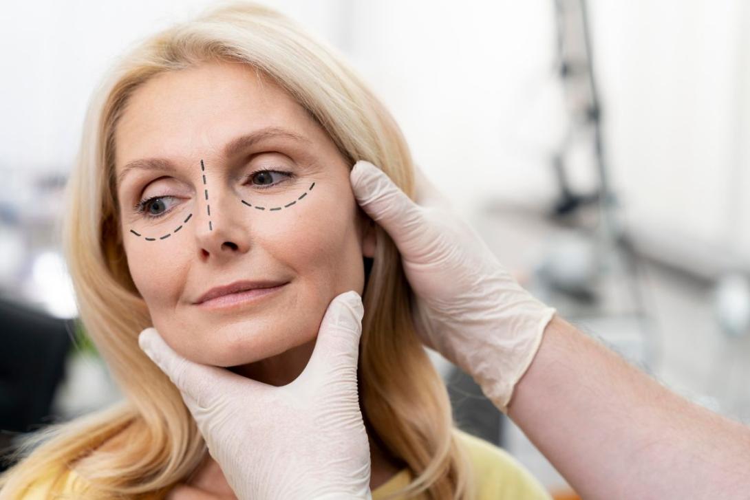 Non-Surgical Facelifts: A Guide to Thread Lifts and Other Techniques
